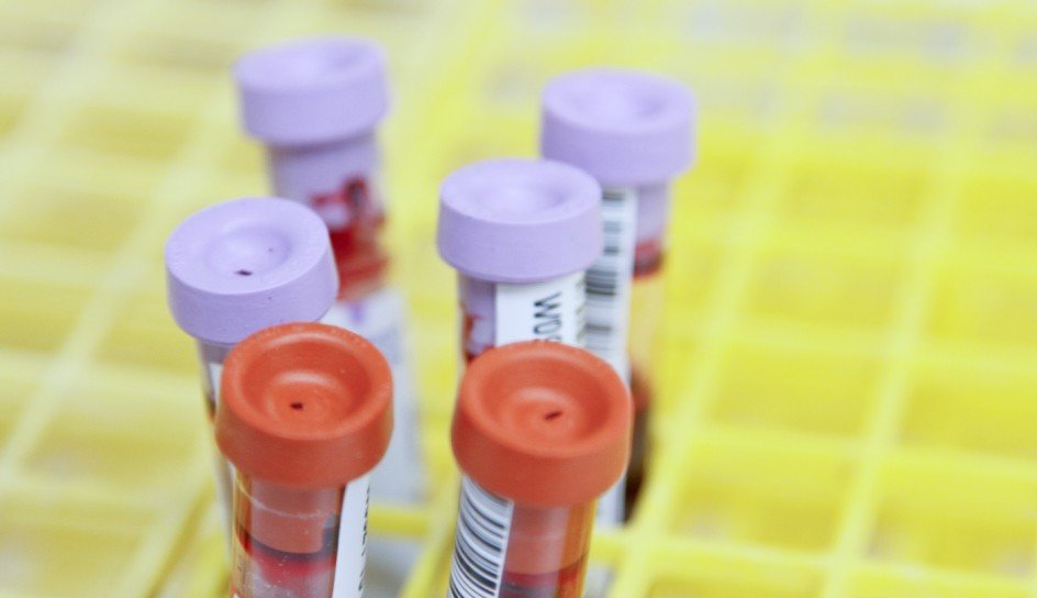 Reliable Pharmaceutical Solutions for Global Healthcare – Ikris
